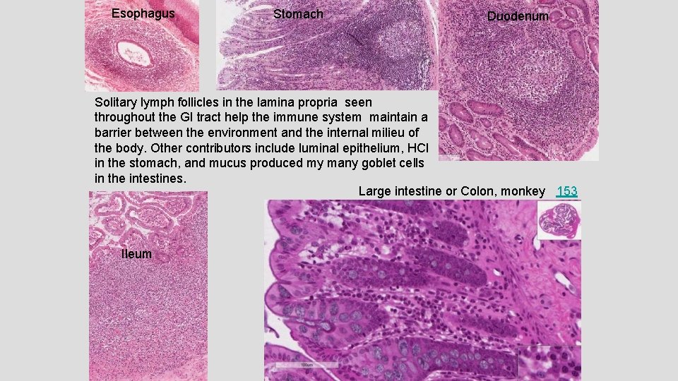 Esophagus Stomach Duodenum Solitary lymph follicles in the lamina propria seen throughout the GI