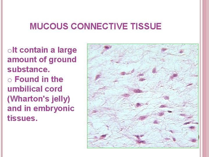 MUCOUS CONNECTIVE TISSUE o. It contain a large amount of ground substance. o Found