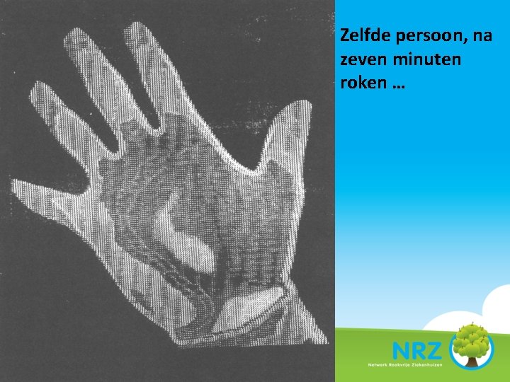 Zelfde persoon, na zeven minuten roken … 