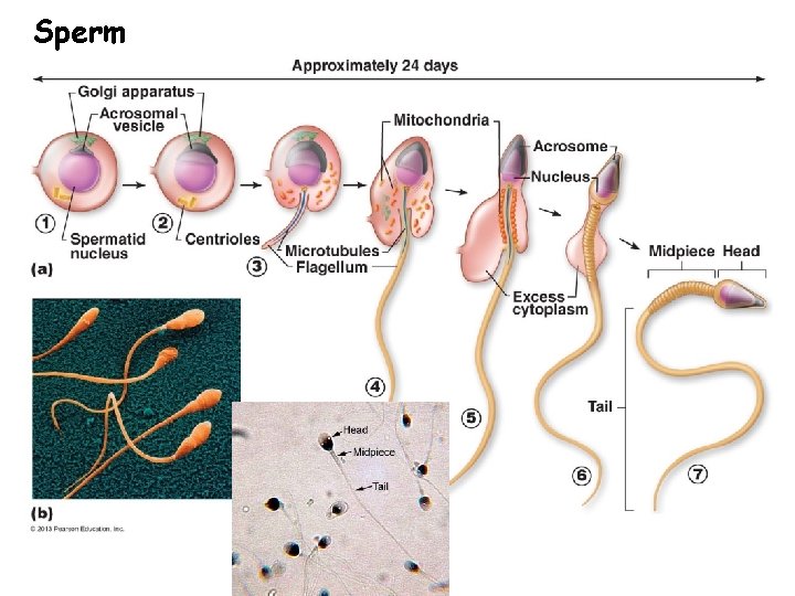 Sperm 