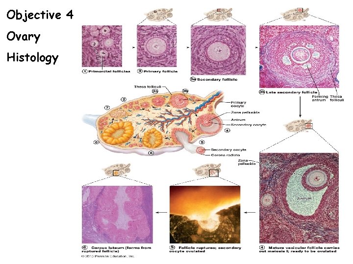 Objective 4 Ovary Histology 