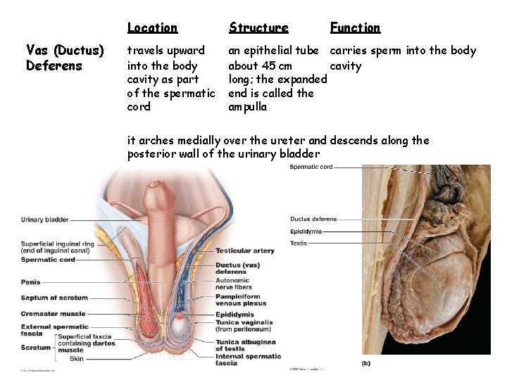 Vas (Ductus) Deferens Location Structure Function travels upward into the body cavity as part