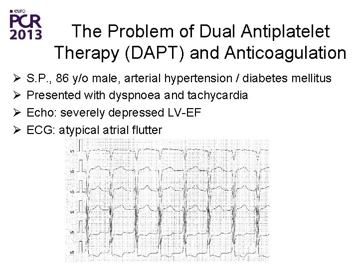 The Problem of Dual Antiplatelet Therapy (DAPT) and Anticoagulation Ø Ø S. P. ,