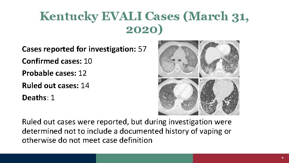 Kentucky EVALI Cases (March 31, 2020) Cases reported for investigation: 57 Confirmed cases: 10