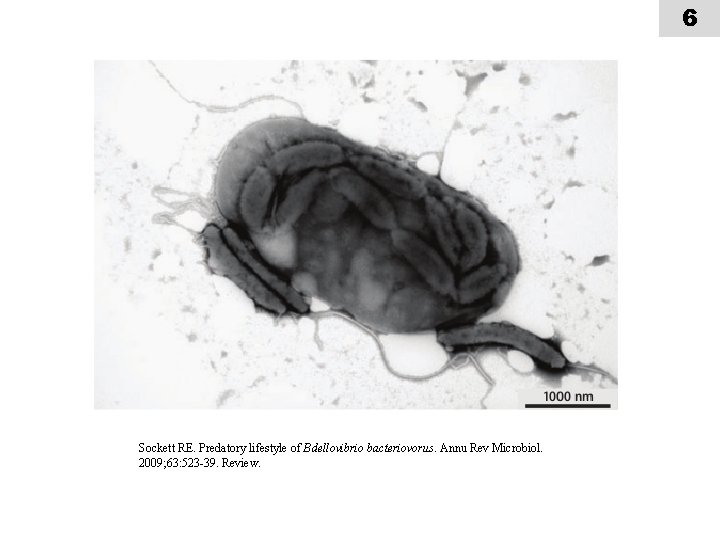 6 Sockett RE. Predatory lifestyle of Bdellovibrio bacteriovorus. Annu Rev Microbiol. 2009; 63: 523