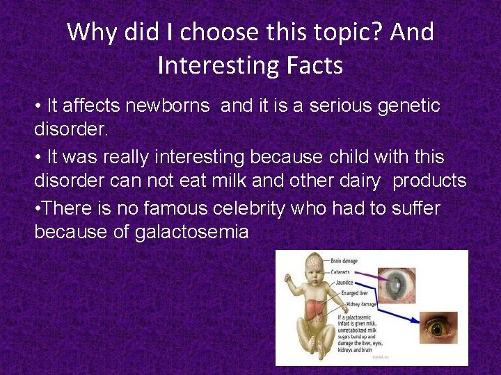 Why did I choose this topic? And Interesting Facts • It affects newborns and