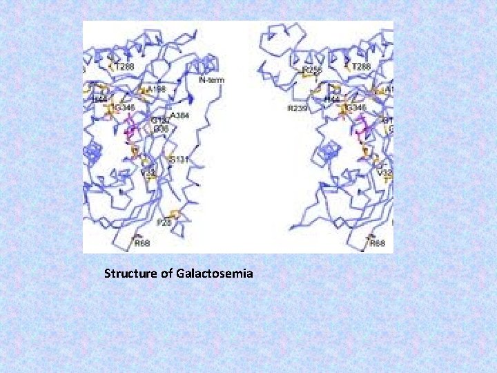 Structure of Galactosemia 
