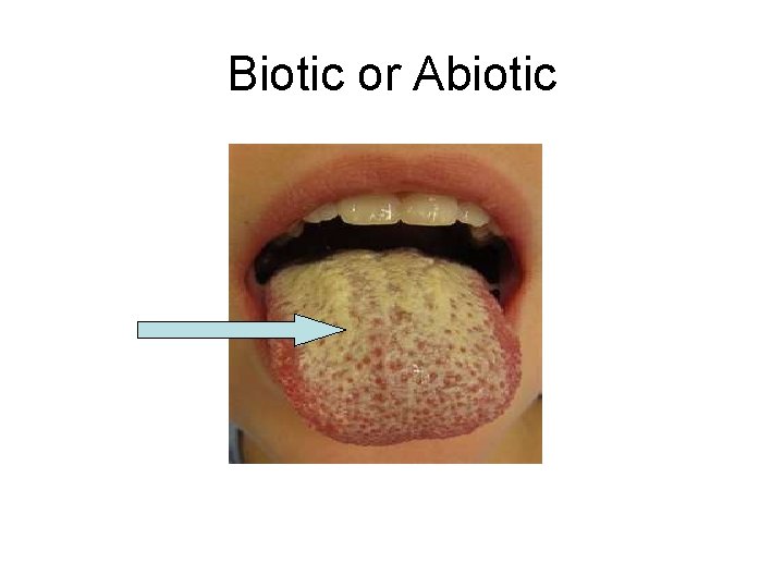 Biotic or Abiotic 