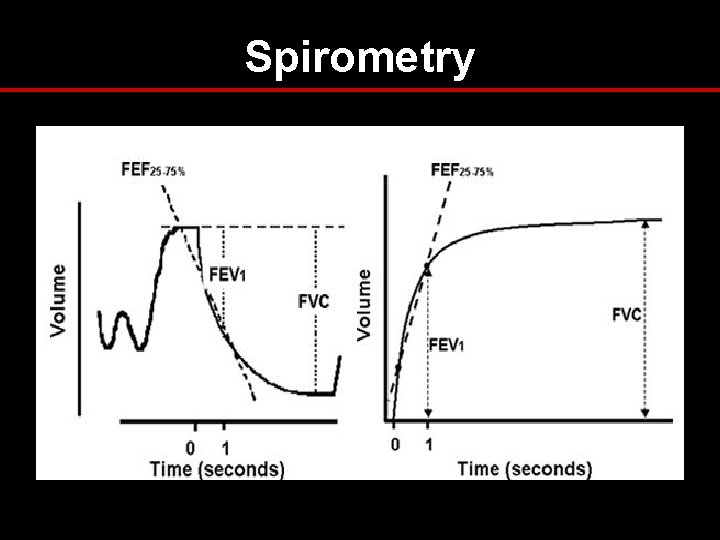 Spirometry Spirometry