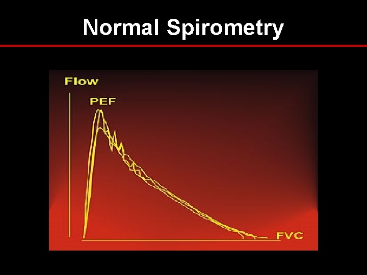 Normal Spirometry Normal Spirometry