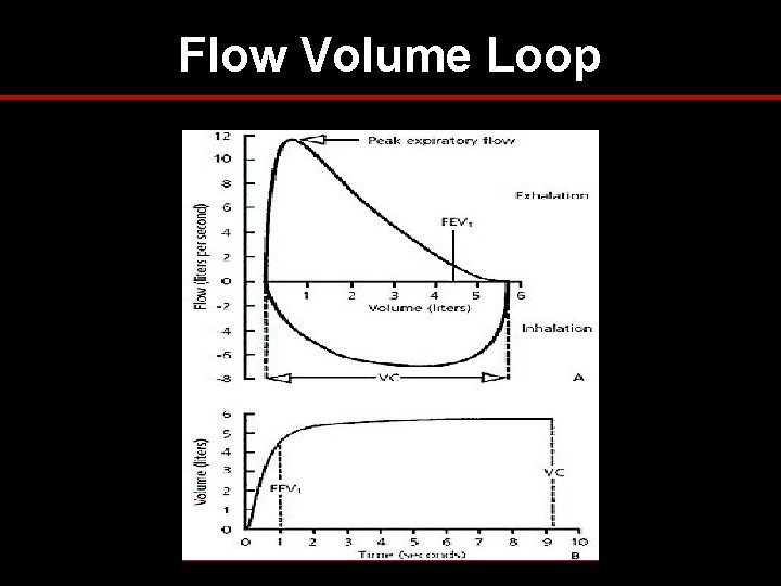 Flow Volume Loop Flow Volume Loop