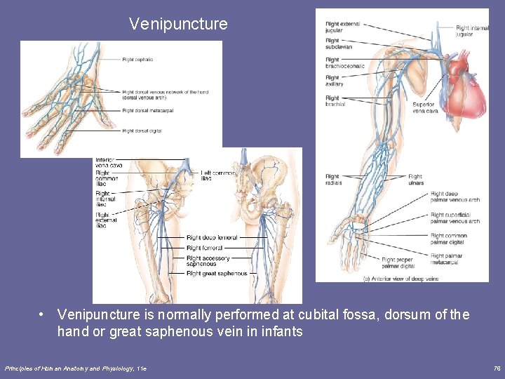 Venipuncture • Venipuncture is normally performed at cubital fossa, dorsum of the hand or Venipuncture • Venipuncture is normally performed at cubital fossa, dorsum of the hand or