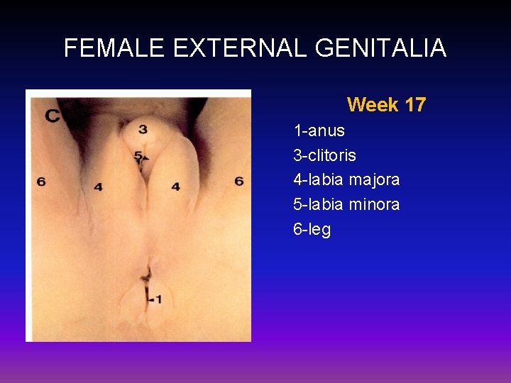 FEMALE EXTERNAL GENITALIA Week 17 1 -anus 3 -clitoris 4 -labia majora 5 -labia