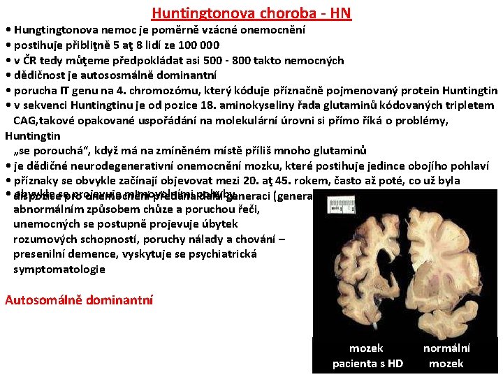 Huntingtonova choroba - HN • Hungtingtonova nemoc je poměrně vzácné onemocnění • postihuje přibliţně