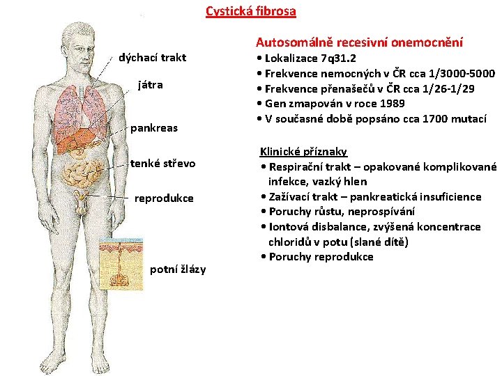 Cystická fibrosa dýchací trakt játra pankreas tenké střevo reprodukce potní žlázy Autosomálně recesivní onemocnění