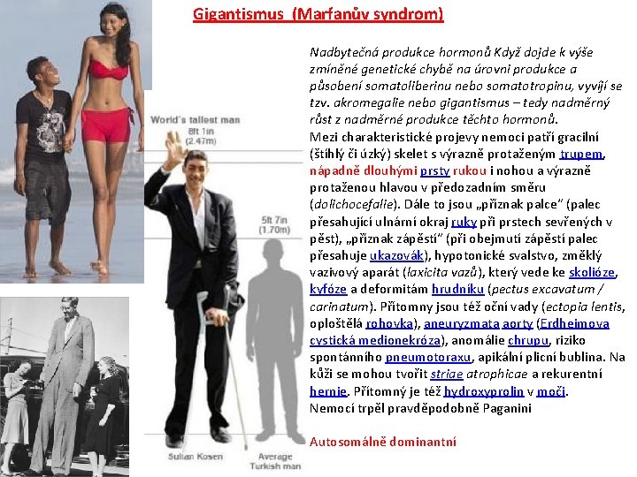 Gigantismus (Marfanův syndrom) Nadbytečná produkce hormonů Když dojde k výše zmíněné genetické chybě na