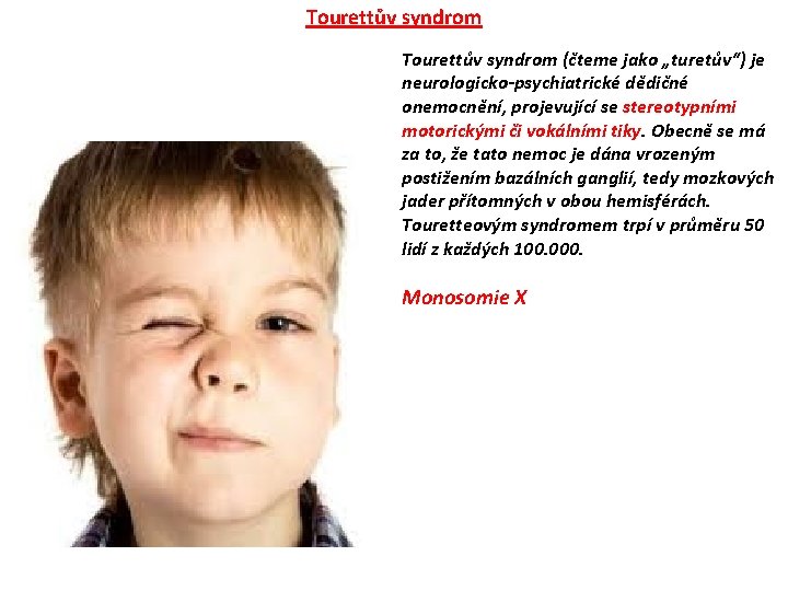 Tourettův syndrom (čteme jako „turetův“) je neurologicko-psychiatrické dědičné onemocnění, projevující se stereotypními motorickými či