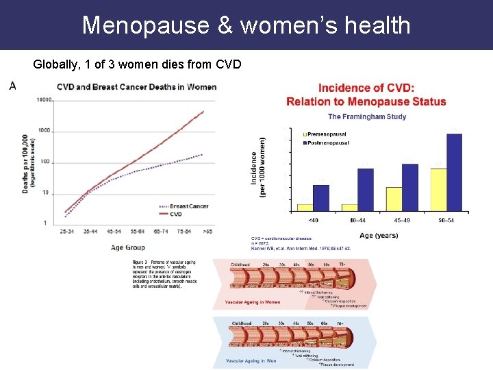 Menopause & women’s health Globally, 1 of 3 women dies from CVD 