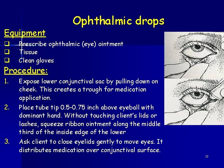 Equipment Ophthalmic drops q q q Prescribe ophthalmic (eye) ointment Tissue Clean gloves 1.