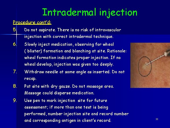 Intradermal injection Procedure cont’d: 5. Do not aspirate. There is no risk of intravascular