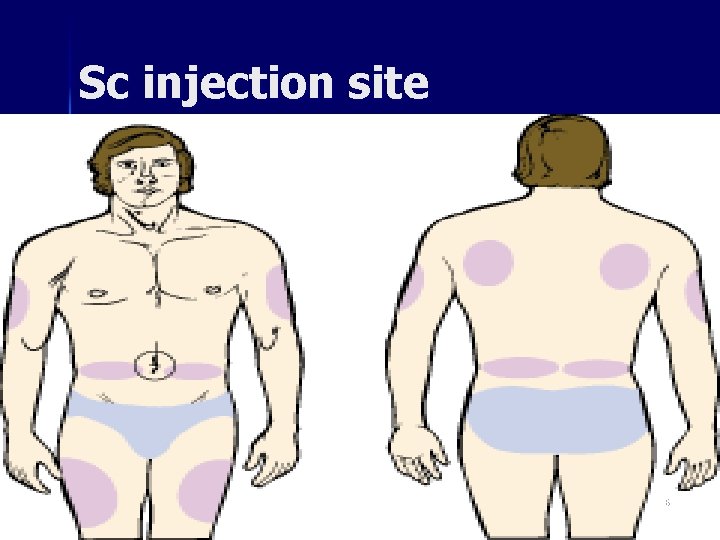 Sc injection site 36 