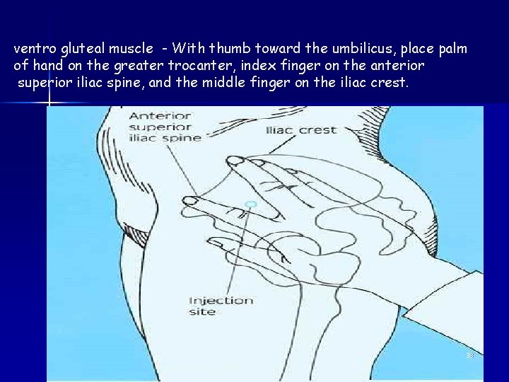 ventro gluteal muscle - With thumb toward the umbilicus, place palm of hand on