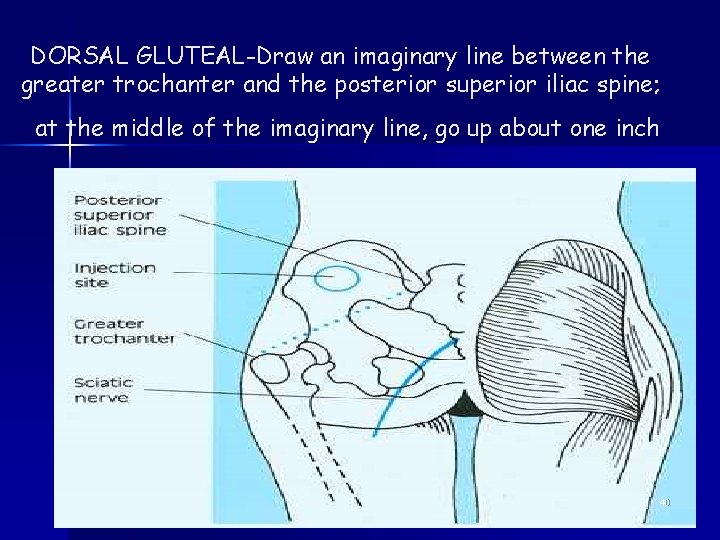 DORSAL GLUTEAL-Draw an imaginary line between the greater trochanter and the posterior superior iliac