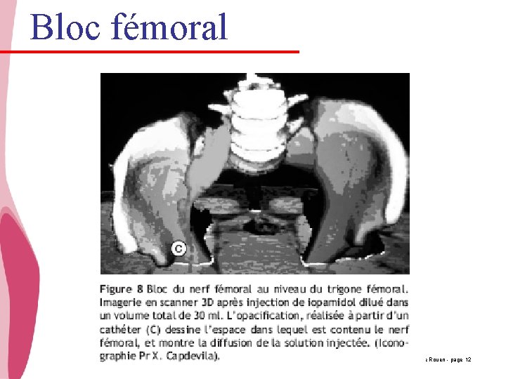 Bloc fémoral CHU_Hôpitaux de Rouen - page 12 