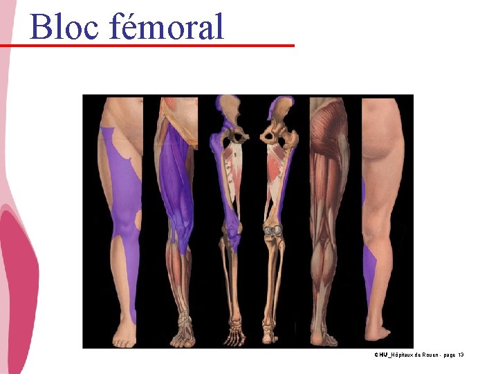Bloc fémoral CHU_Hôpitaux de Rouen - page 13 
