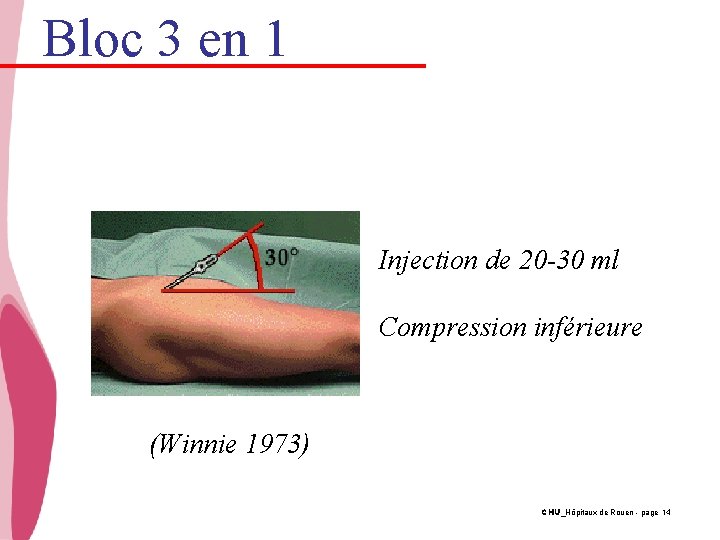 Bloc 3 en 1 Injection de 20 -30 ml Compression inférieure (Winnie 1973) CHU_Hôpitaux