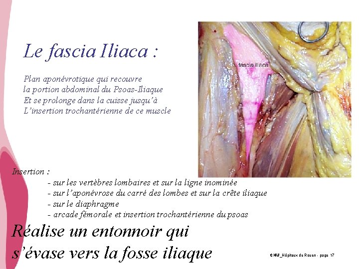Le fascia Iliaca : Plan aponévrotique qui recouvre la portion abdominal du Psoas-Iliaque Et