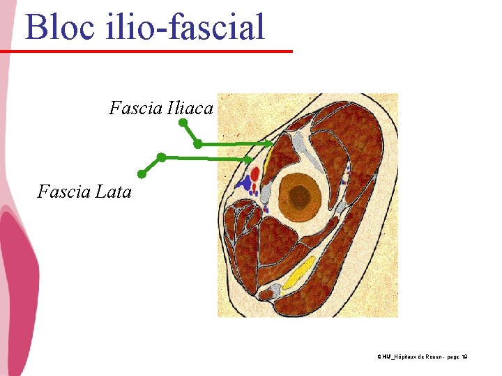 Bloc ilio-fascial Fascia Iliaca Fascia Lata CHU_Hôpitaux de Rouen - page 19 