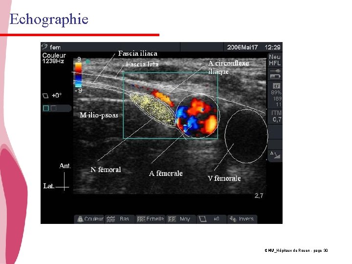 Echographie CHU_Hôpitaux de Rouen - page 30 