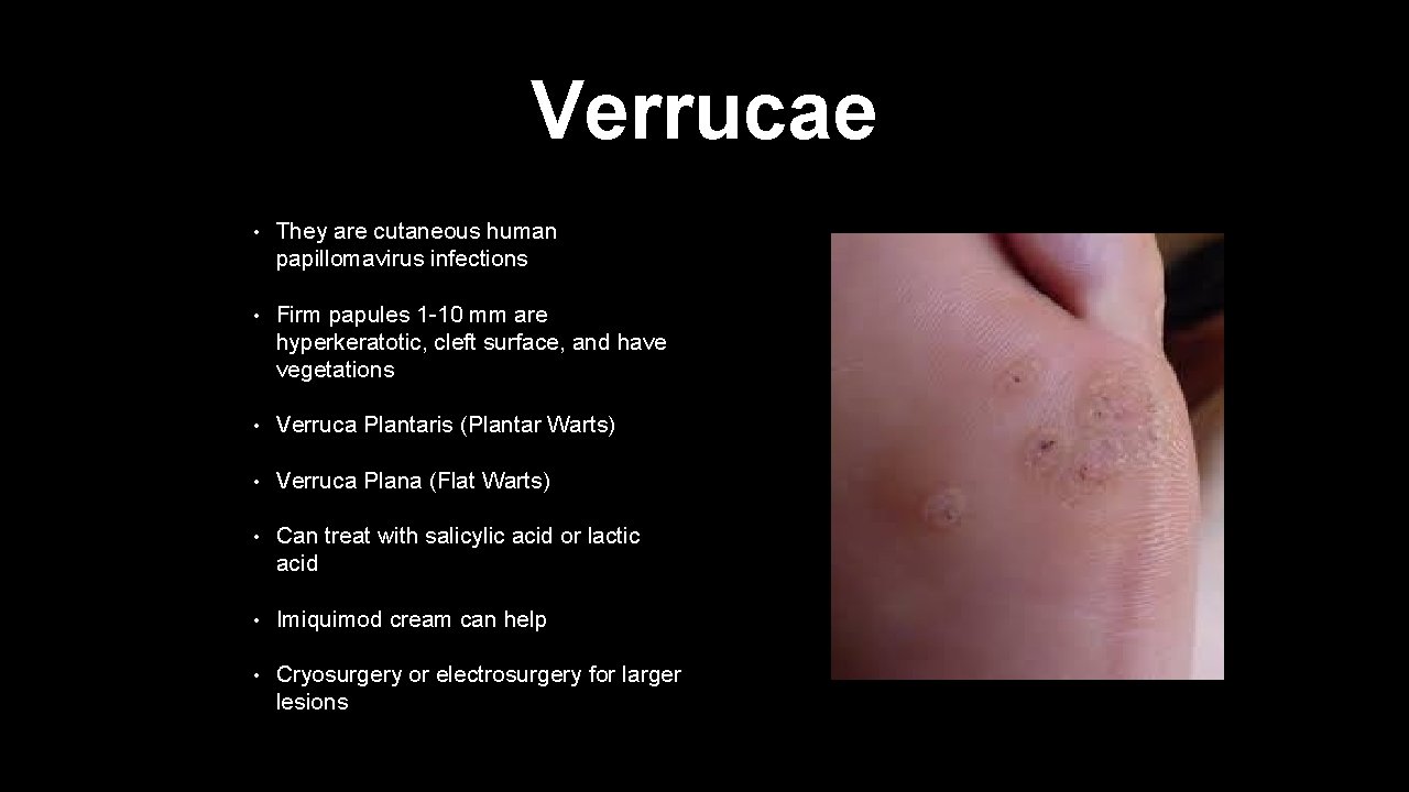 Verrucae • They are cutaneous human papillomavirus infections • Firm papules 1 -10 mm