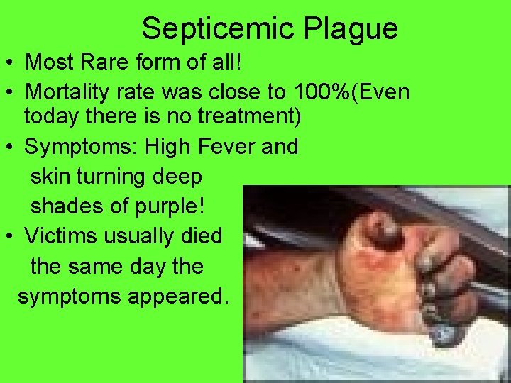 Septicemic Plague • Most Rare form of all! • Mortality rate was close to
