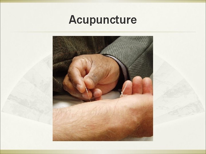 Acupuncture 