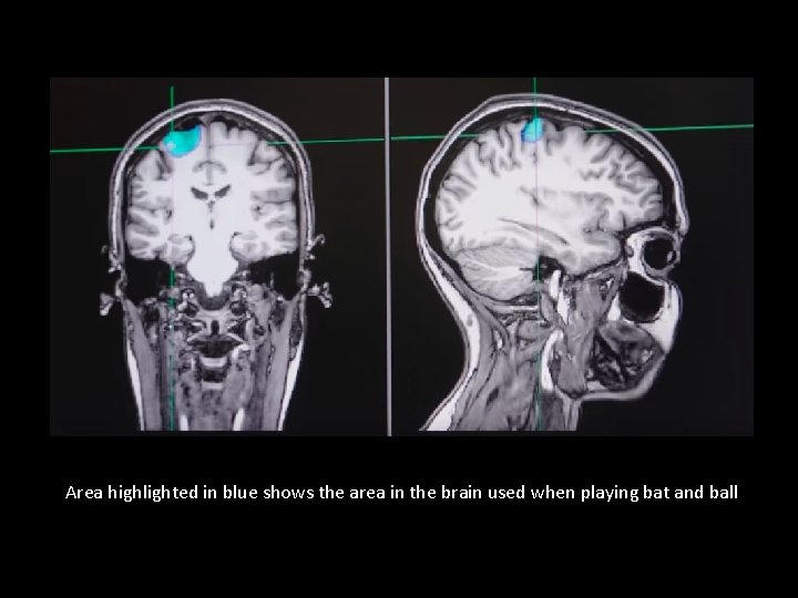 Area highlighted in blue shows the area in the brain used when playing bat