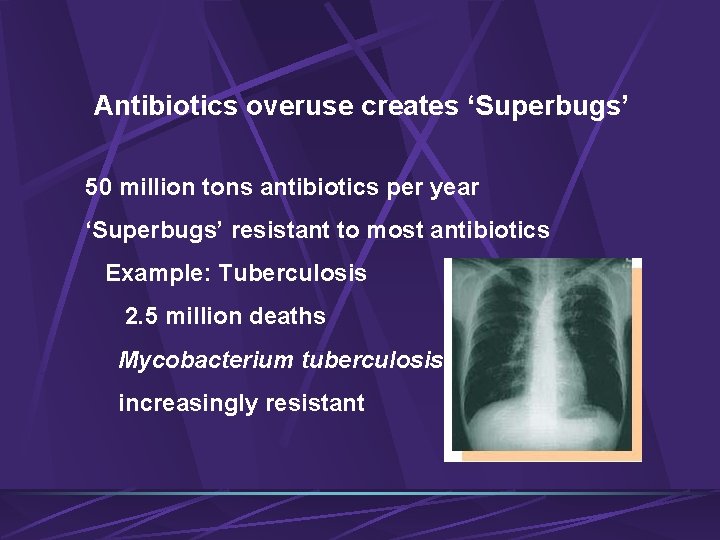 Antibiotics overuse creates ‘Superbugs’ 50 million tons antibiotics per year ‘Superbugs’ resistant to most