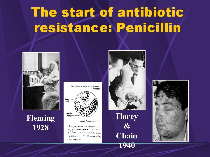 The start of antibiotic resistance: Penicillin Fleming 1928 Florey & Chain 1940 