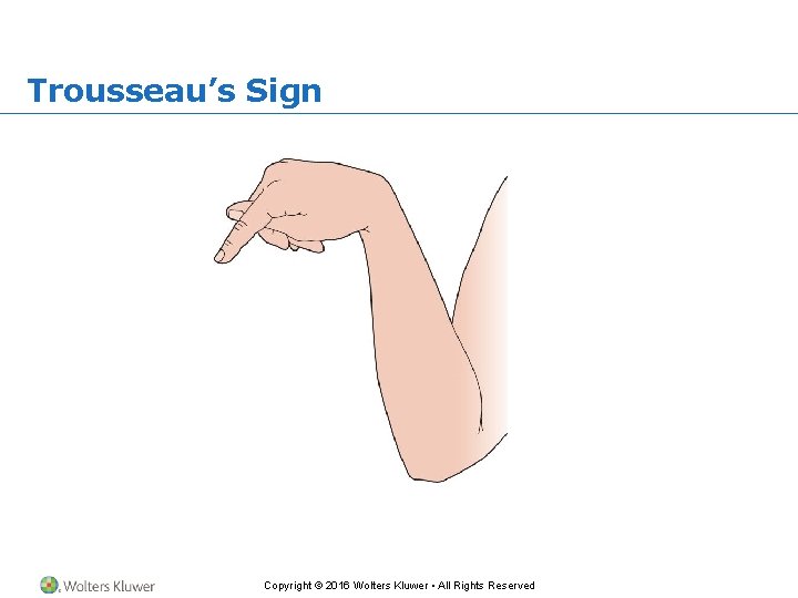 Trousseau’s Sign Copyright © 2016 Wolters Kluwer • All Rights Reserved 