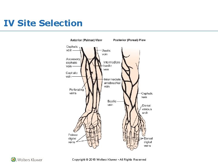 IV Site Selection Copyright © 2016 Wolters Kluwer • All Rights Reserved 