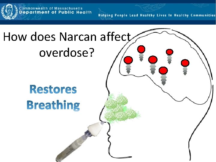 How does Narcan affect overdose? 