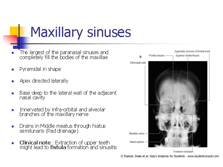Maxillary sinuses n The largest of the paranasal sinuses and completely fill the bodies