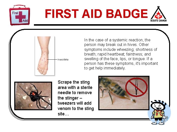 FIRST AID BADGE In the case of a systemic reaction, the person may break