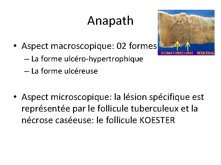 Anapath • Aspect macroscopique: 02 formes – La forme ulcéro-hypertrophique – La forme ulcéreuse