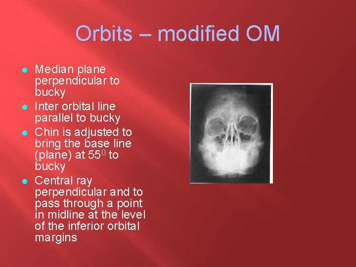 Orbits – modified OM l l Median plane perpendicular to bucky Inter orbital line