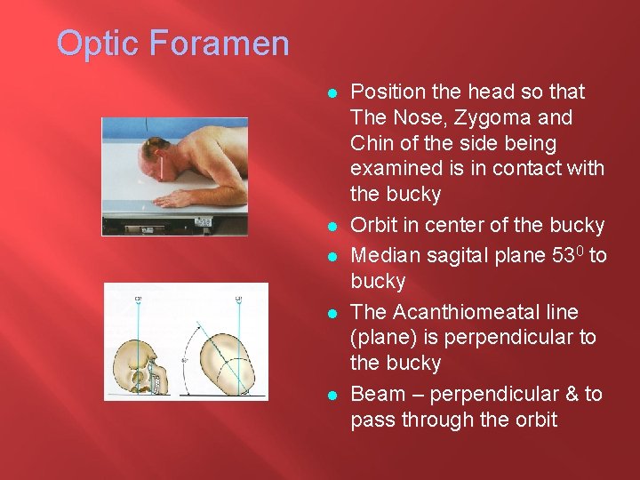 Optic Foramen l l l Position the head so that The Nose, Zygoma and