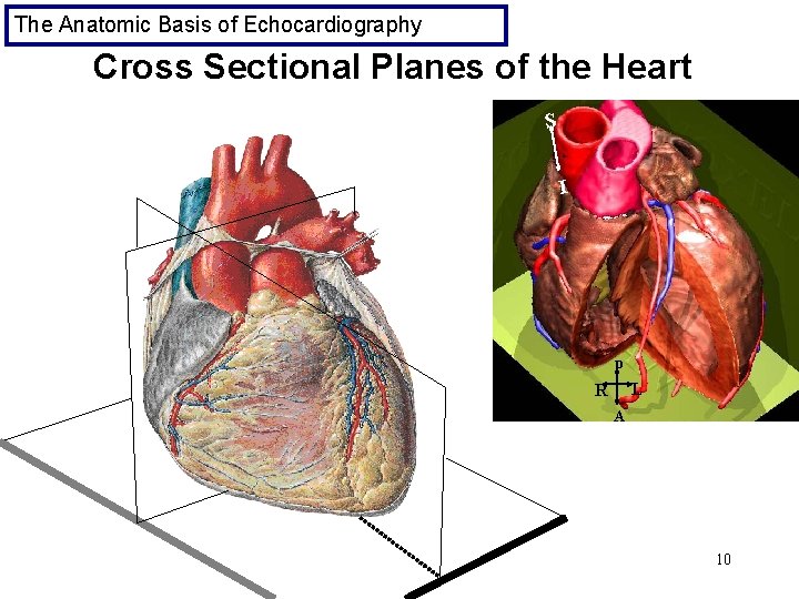 The Anatomic Basis of Echocardiography Cross Sectional Planes of the Heart S I p