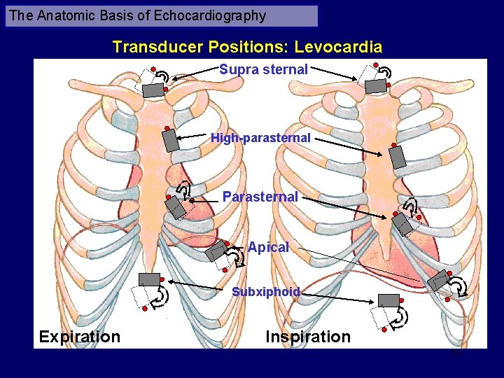 The Anatomic Basis of Echocardiography Transducer Positions: Levocardia Supra sternal High-parasternal Parasternal Apical Subxiphoid