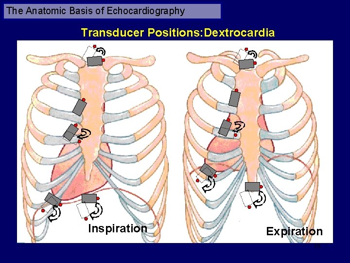The Anatomic Basis of Echocardiography Transducer Positions: Dextrocardia Inspiration Expiration 16 